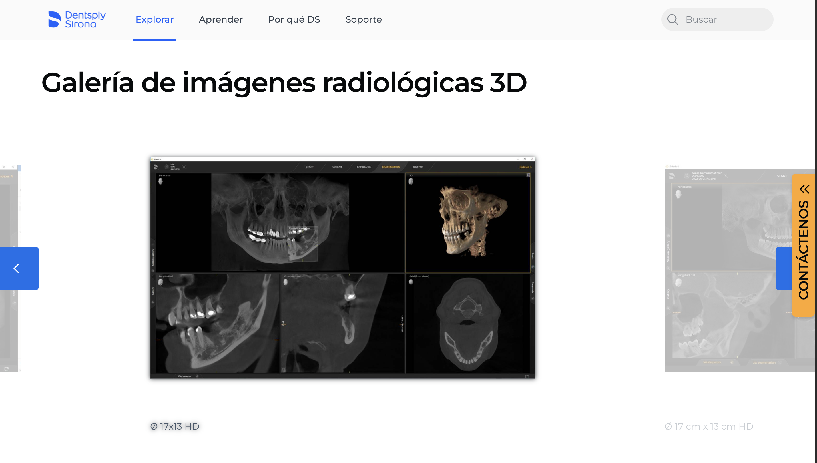 Video o Imagen Axeos
